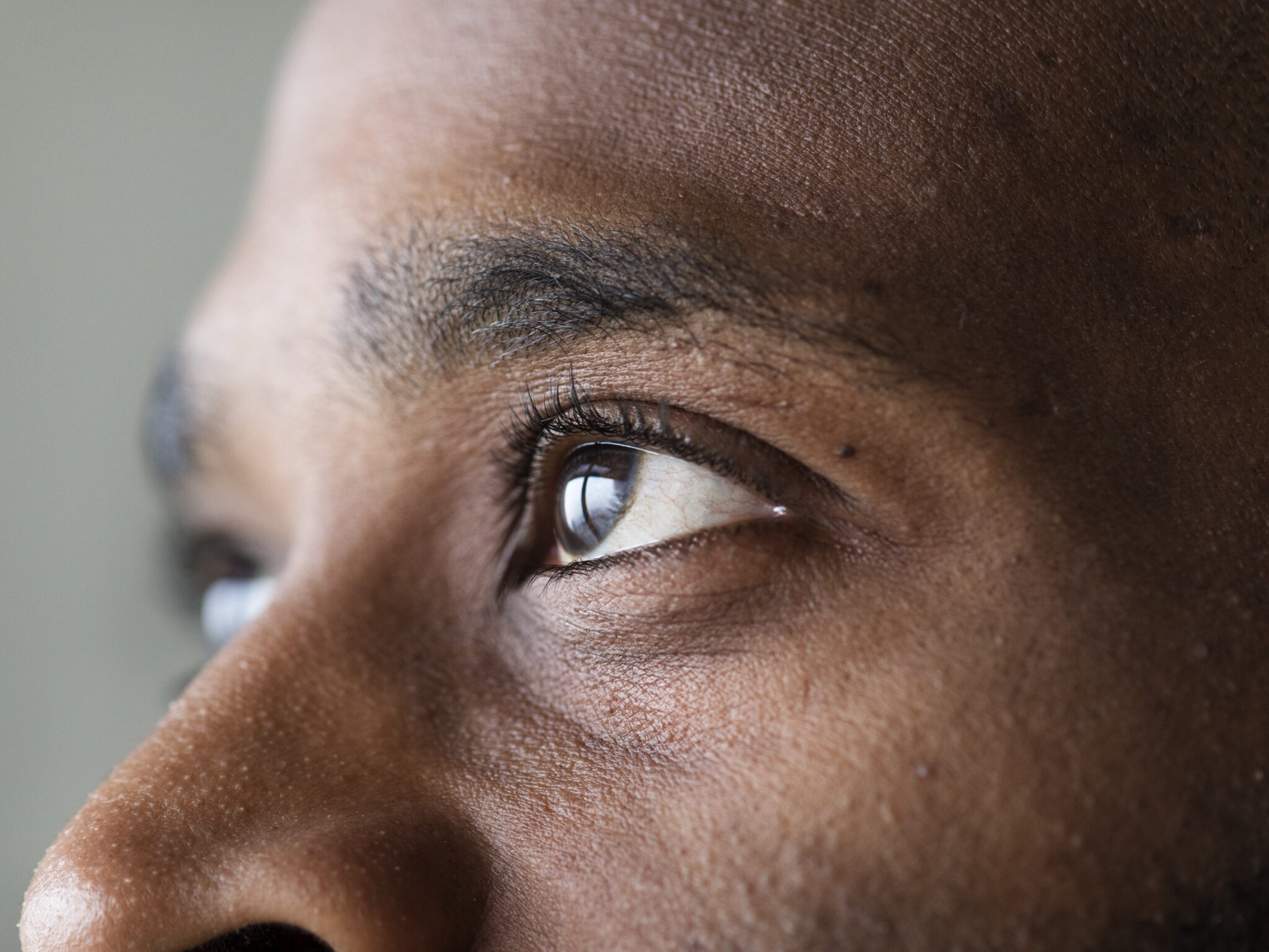 Squint and Lid Surgery In Abuja - Peniel Eye Clinic And Surgery